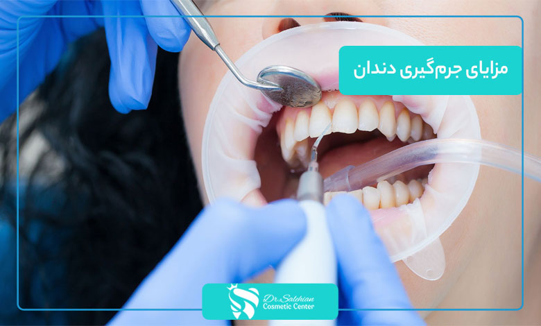 مزایای جرم‌گیری دندان