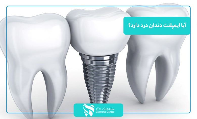 آیا ایمپلنت دندان درد دارد؟
