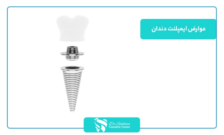 عوارض ایمپلنت دندان