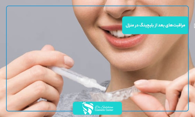 مراقبت‌های بعد از بلیچینگ در منزل