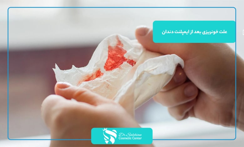 علت خونریزی بعد از ایمپلنت دندان