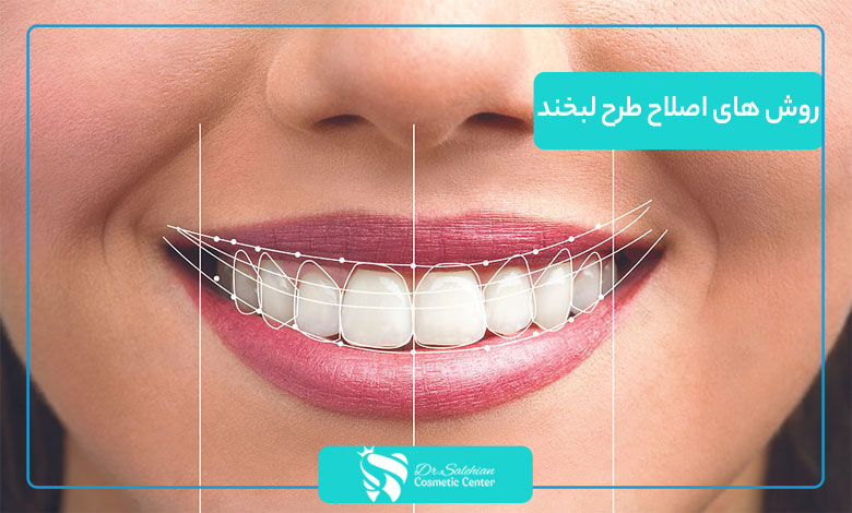 روش های اصلاح طرح لبخند + قیمت 1404