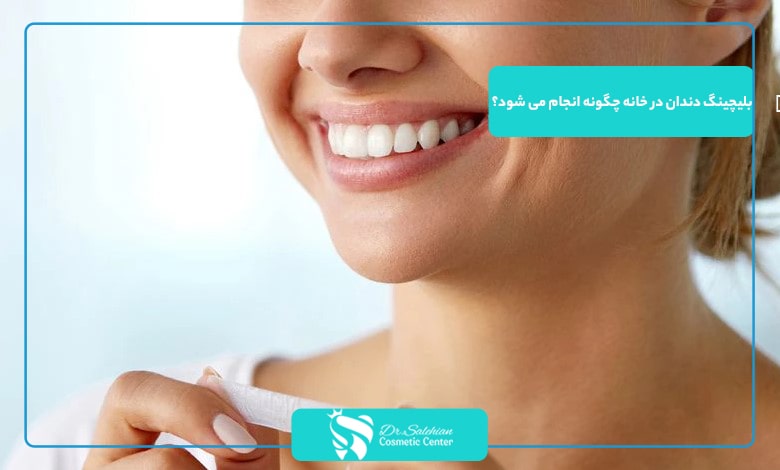 بلیچینگ دندان در خانه چگونه انجام می شود؟
