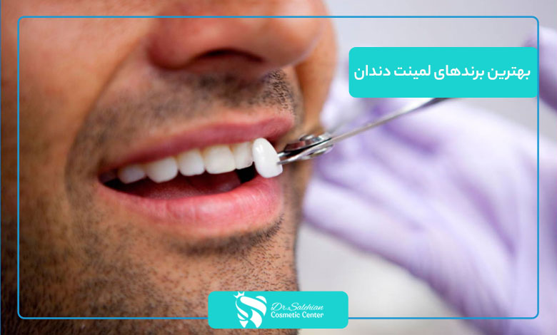 بهترین برندهای لمینت دندان بدون تراش چیست؟