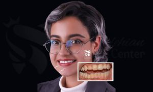 کاندیدای مناسب برای مراجعه به بهترین کلینیک دندانپزشکی در تهران
