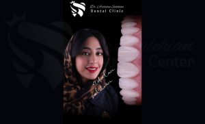 هزینه خدمات در بهترین کلینیک دندانپزشکی تهران