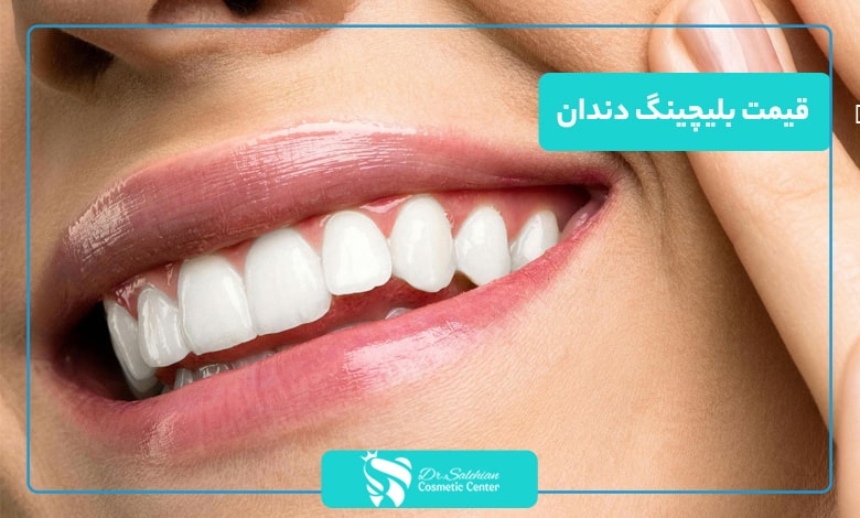 قیمت بلیچینگ دندان