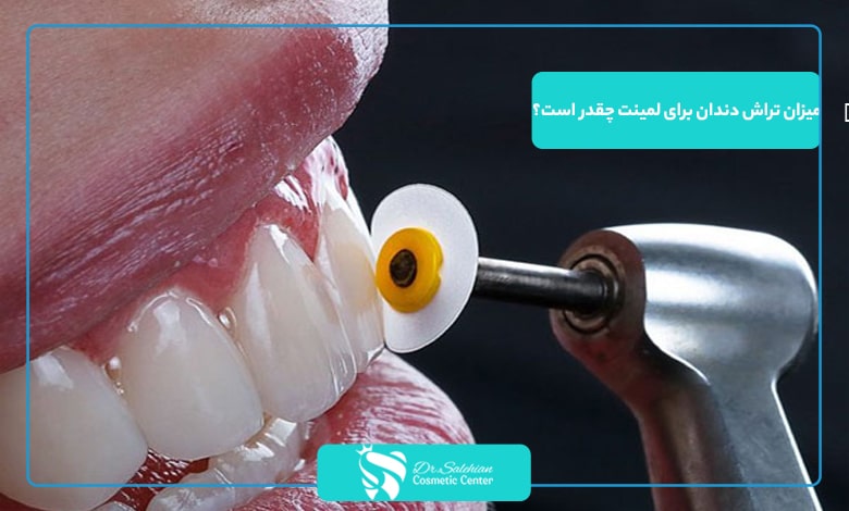میزان تراش دندان برای لمینت چقدر است؟
