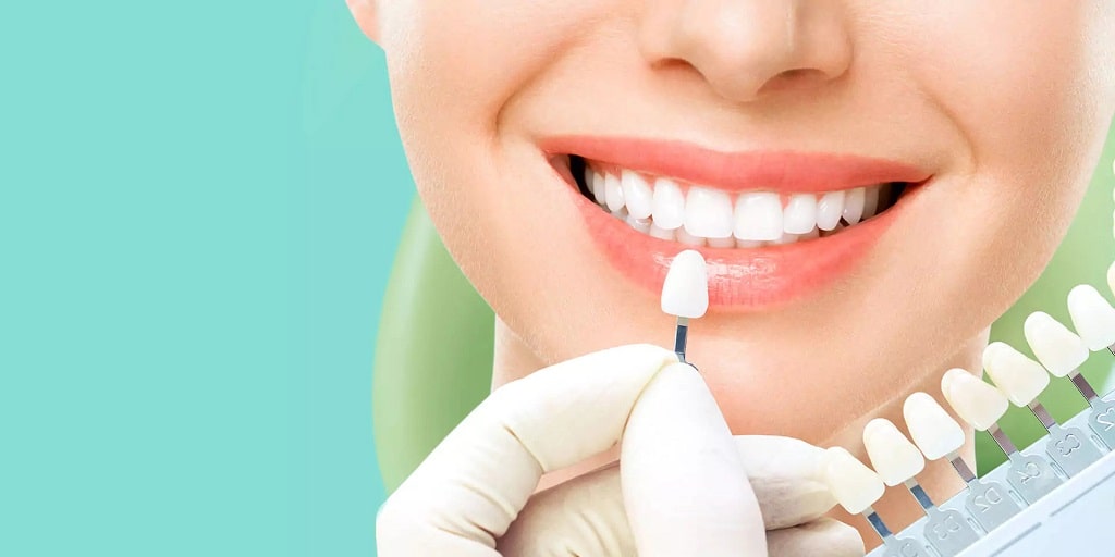 خدمات زیبایی دندان