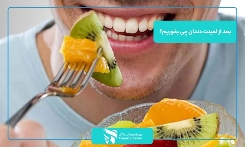 بعد از لمینت دندان چی بخوریم؟