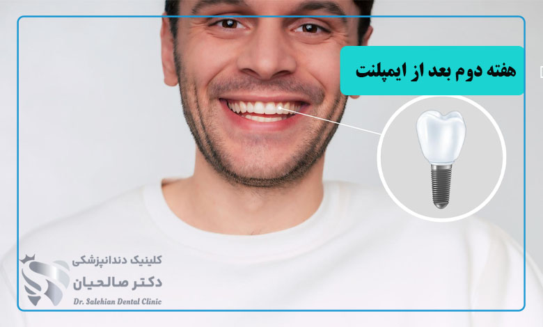 مراقبت های بعد از ایمپلنت دندان (هفته دوم تا پایان ماه اول)