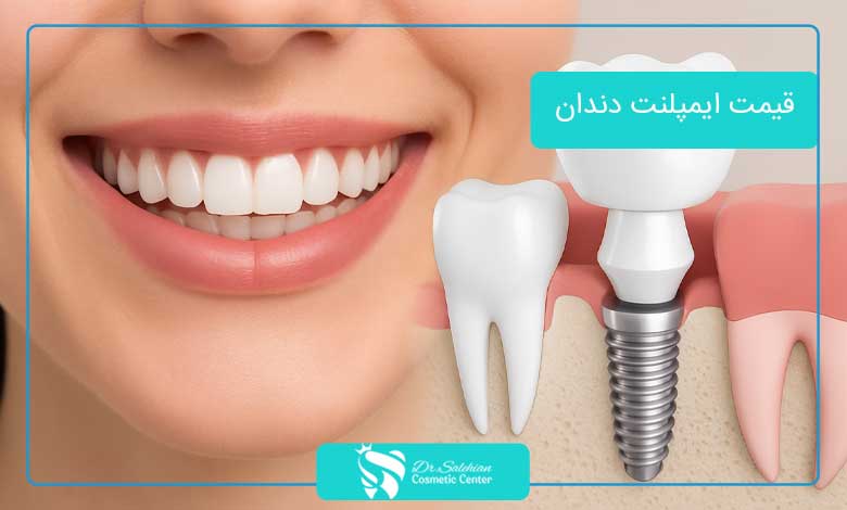 قیمت ایمپلنت دندان