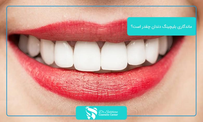 ماندگاری بلیچینگ دندان چقدر است؟