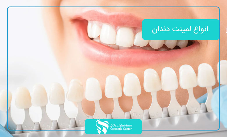 انواع لمینت دندان