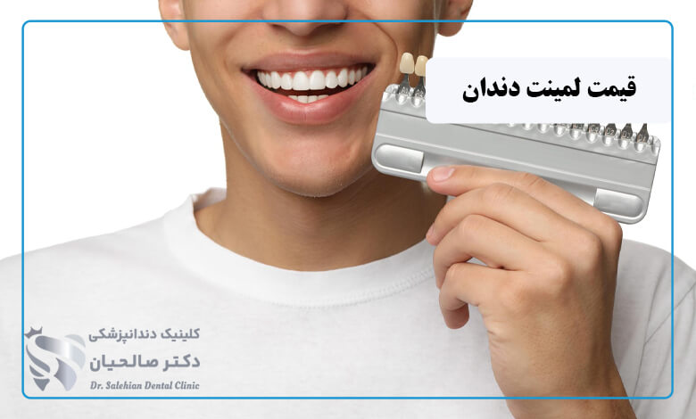 قیمت لمینت دندان در تهران