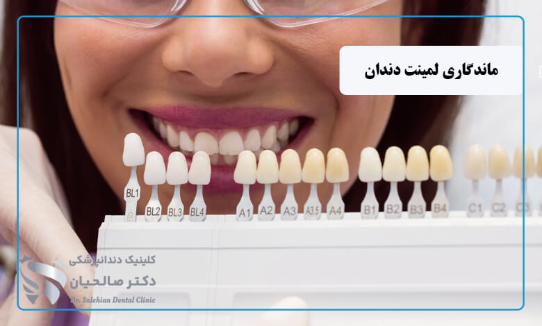 طول عمر لمینت دندان