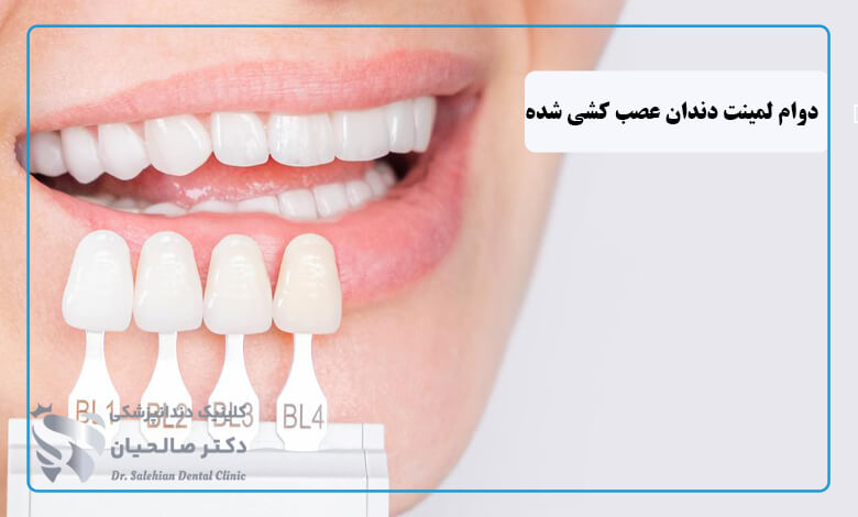 ماندگاری لمینت دندان عصب کشی شده
