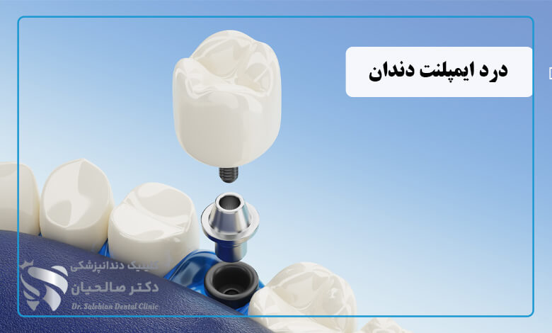 درد ایمپلنت دندان تا چند روز طبیعی است