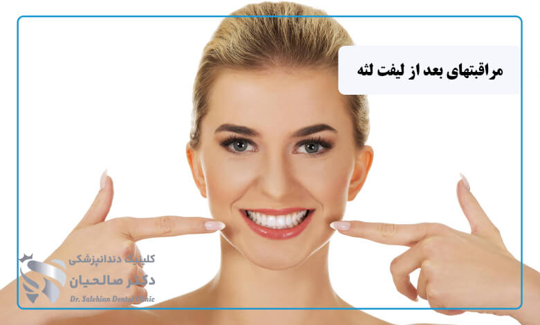 مراقبتهای بعد از جراحی لیفت لثه