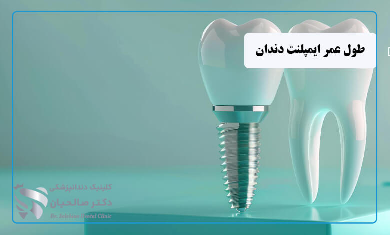 طول عمر ایمپلنت دندان بر اساس کشور سازنده