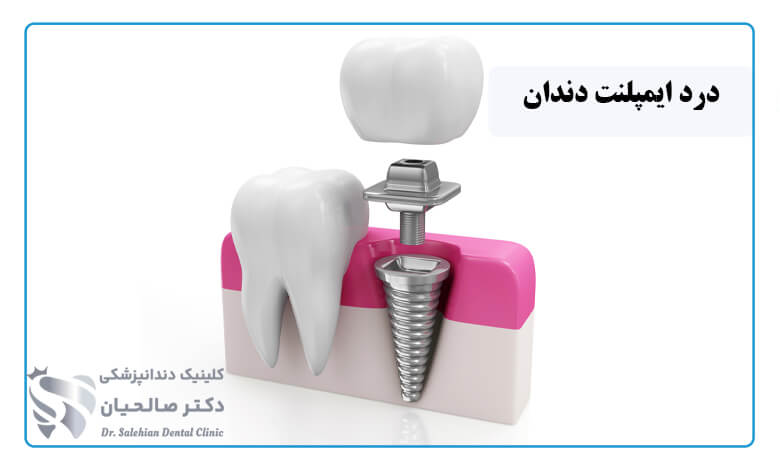 درد ایمپلنت دندان