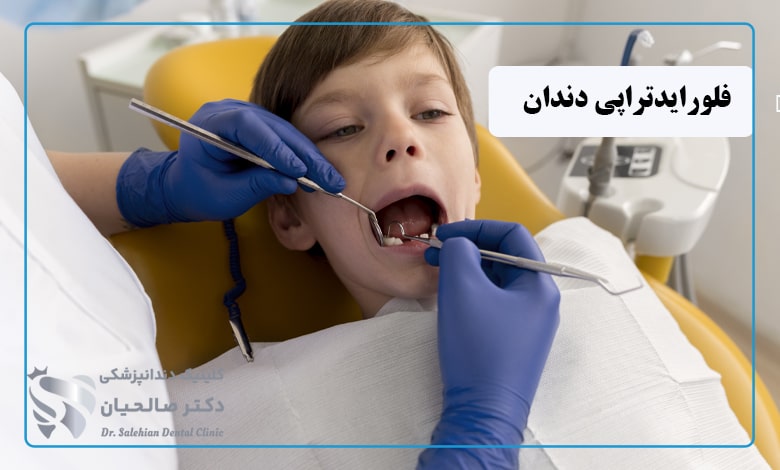 فلورایدتراپی دندان