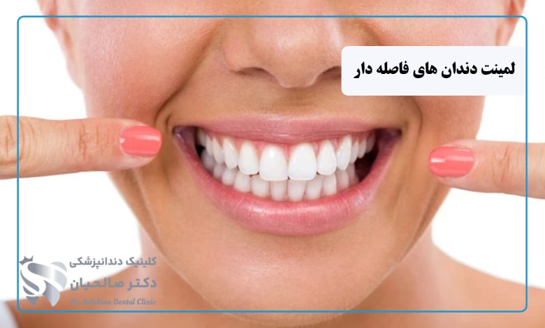 لمینت دندان های فاصله دار
