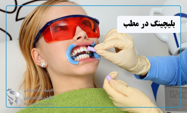 بلیچینگ دندان در مطب