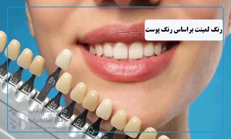 انتخاب رنگ لمینت دندان براساس رنگ پوست