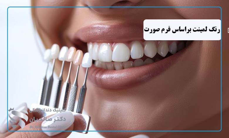 انتخاب بهترین رنگ لمینت دندان متناسب با فرم صورت