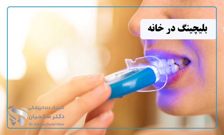 عکس بلیچینگ در خانه توسط خود فرد