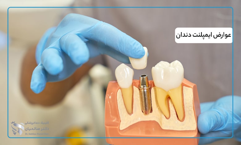 عوارض ایمپلنت دندان