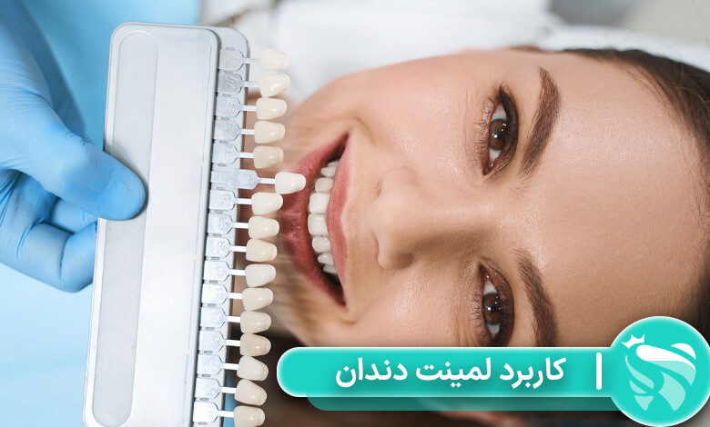 لمینت دندان چیست چه کاربردی دارد