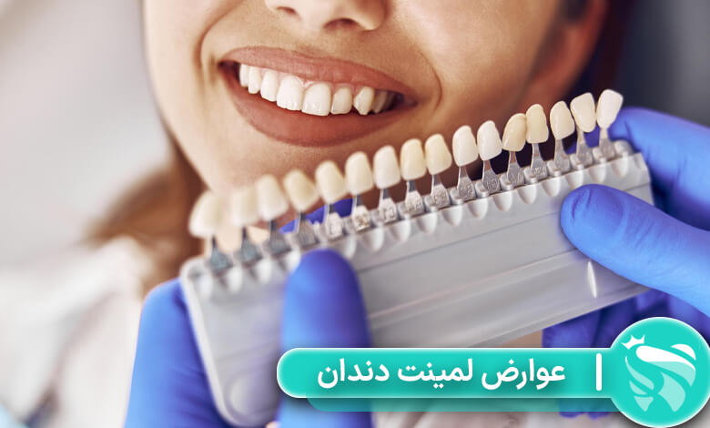 عوارض لمینت دندان
