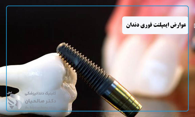 عوارض ایمپلنت فوری دندان چیست