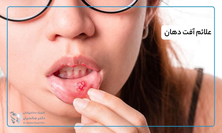علائم آفت دهان چیست
