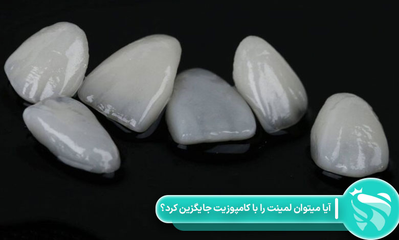 آیا میتوان لمینت را با کامپوزیت جایگزین کرد؟