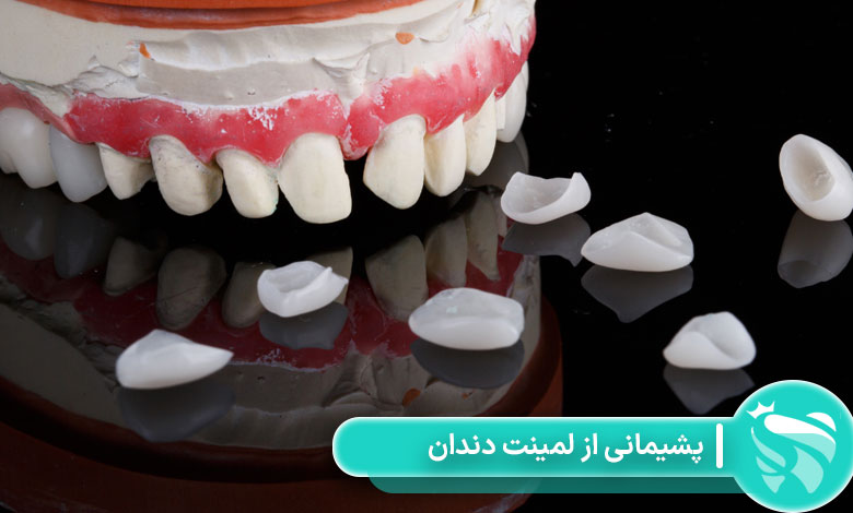 پشیمانی از لمینت دندان