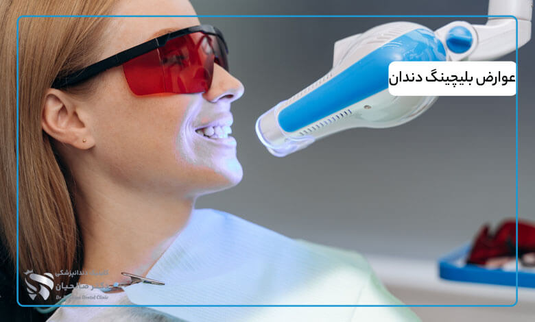 عوارض بلیچینگ دندان