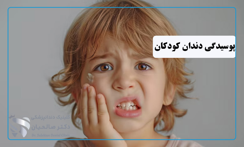 پوسیدگی دندان کودکان
