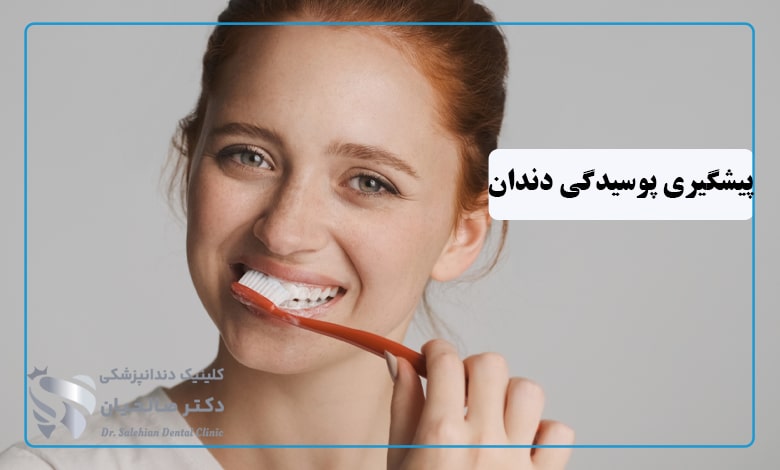 روش های پیشگیری از پوسیدگی دندان