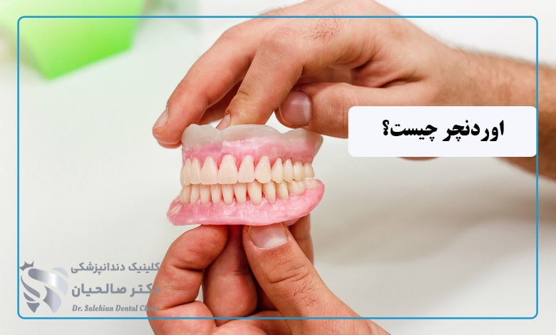 اوردنچر چیست